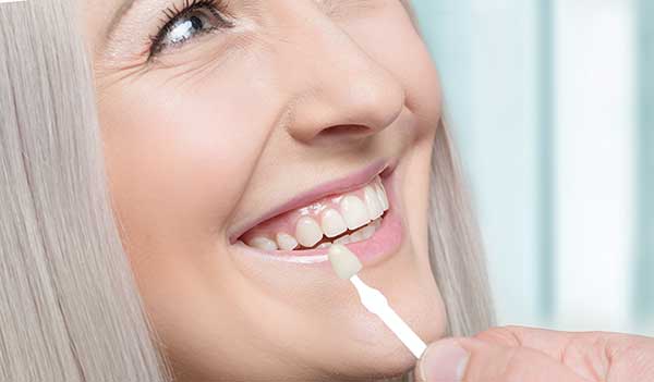 Woman smiling with brandnew veneers