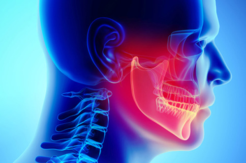 3D illustration of mandible to guide orthognathic surgery at Surf City Oral and Maxillofacial Surgery in Huntington Beach, CA